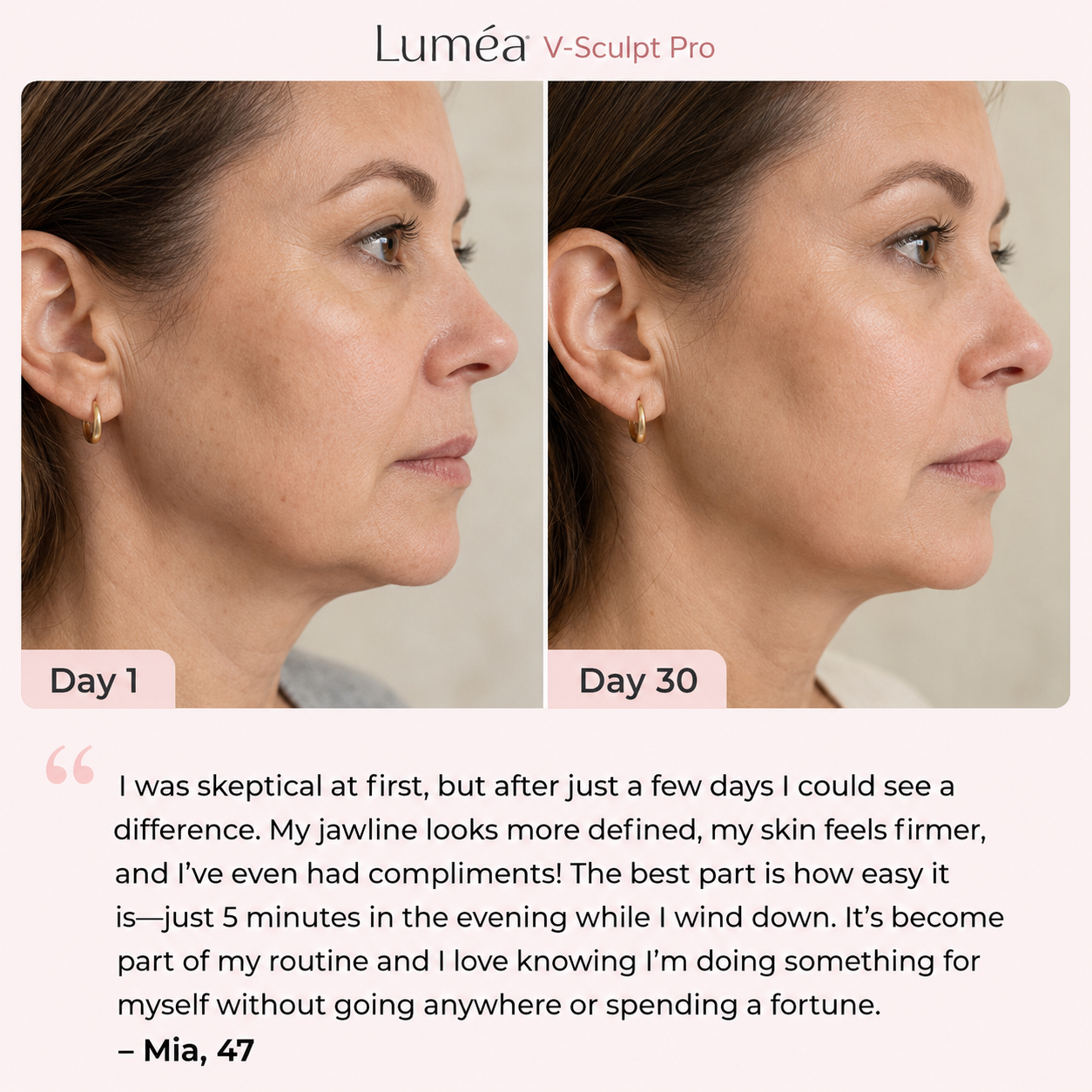 Luméa V-Sculpt Pro — image 8